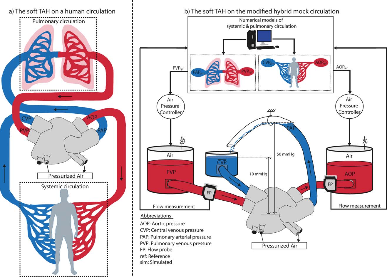 Artificial Heart Diagram